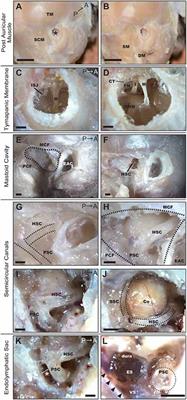 Anatomical and Surgical Evaluation of the Common Marmoset as an Animal Model in Hearing Research